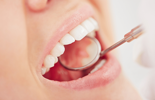 歯科医による歯のチェック